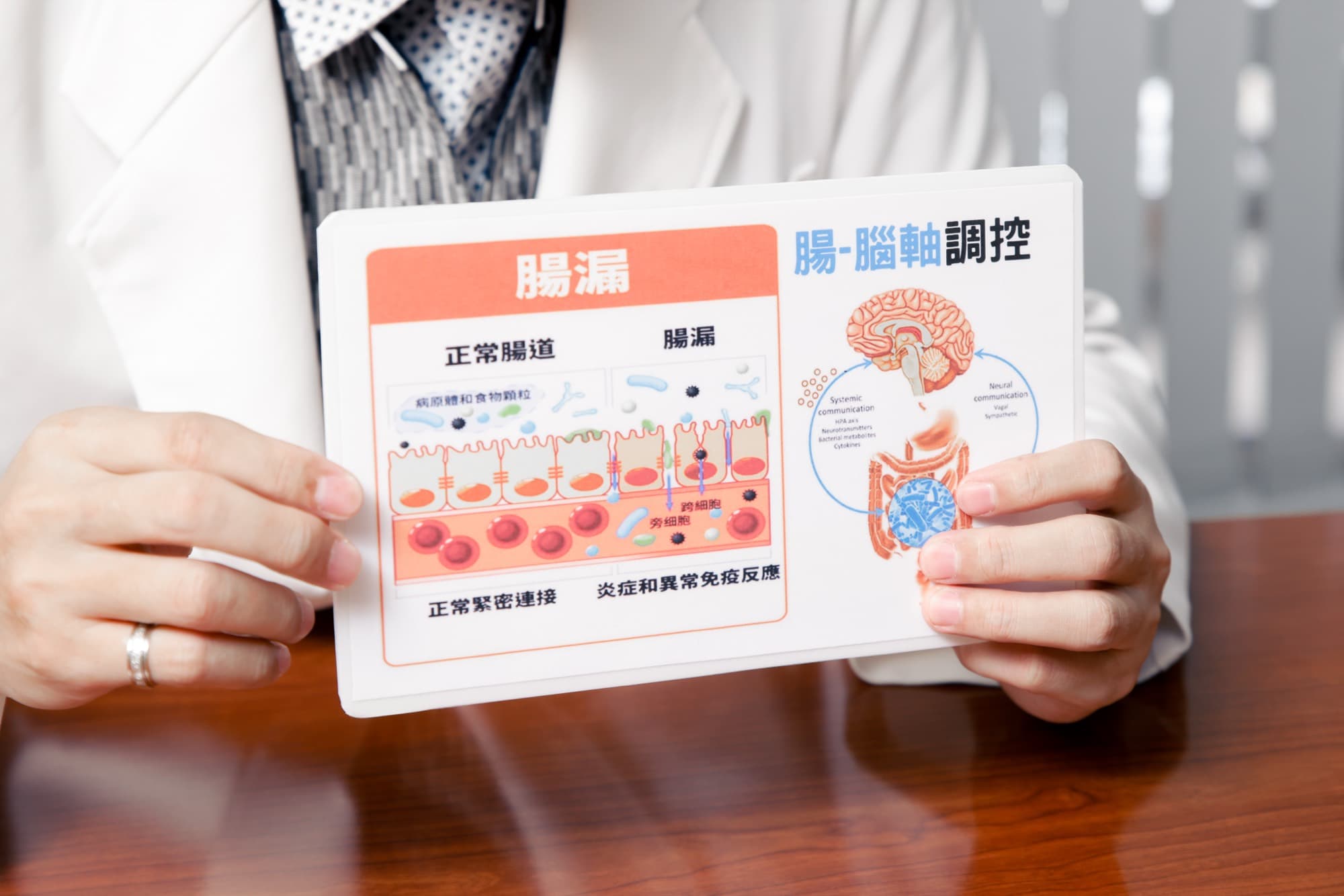 雙手持腸漏與腸腦軸調控衛教圖卡的特寫
